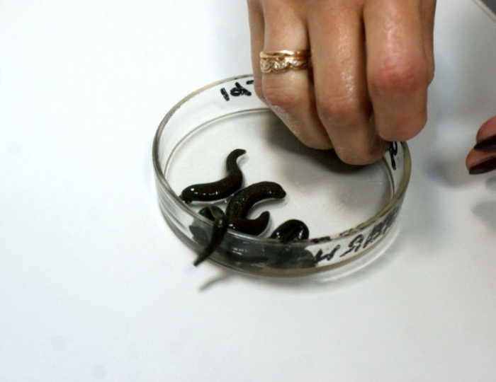 Гирудотерапия - Оздоровительные услуги - Санаторий «Белая Русь» Беларусь