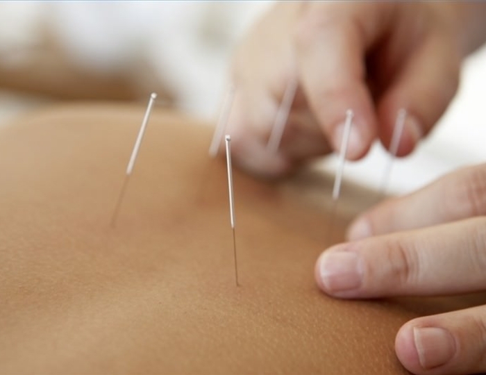 Иглорефлексо- и озокеритопарафинотерапия - Санаторий «Белая Русь» Беларусь